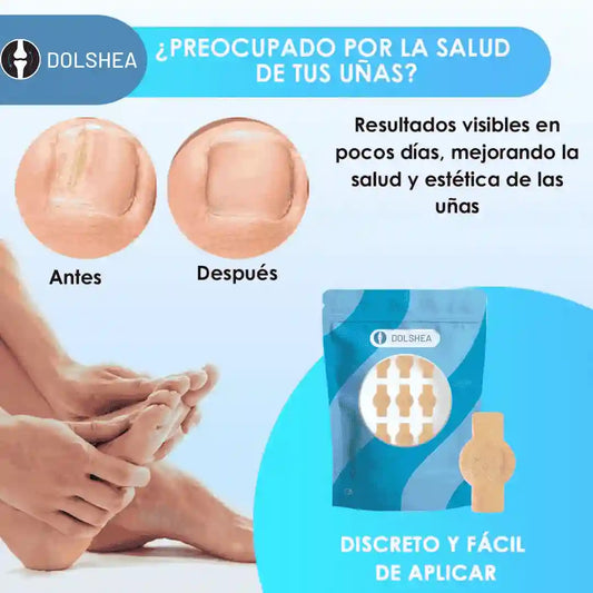DOLSHEA® ADESIVOS ANTIFÚNGICOS