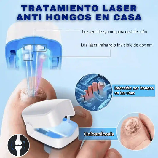 Laser eliminador de hongos en uñas